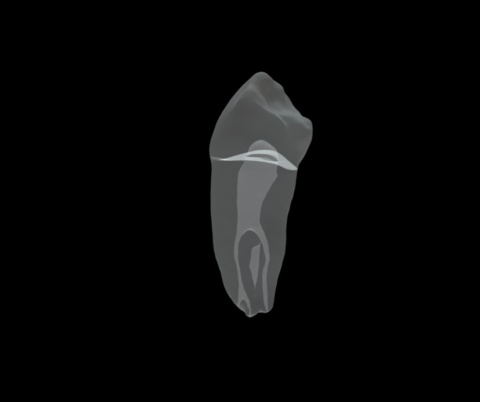 BIOMED 3D Tooth - Ząb treningowy - 28 Premolar