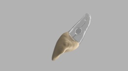 BIOMED 3D Tooth - Ząb treningowy - 9 z resorpcją